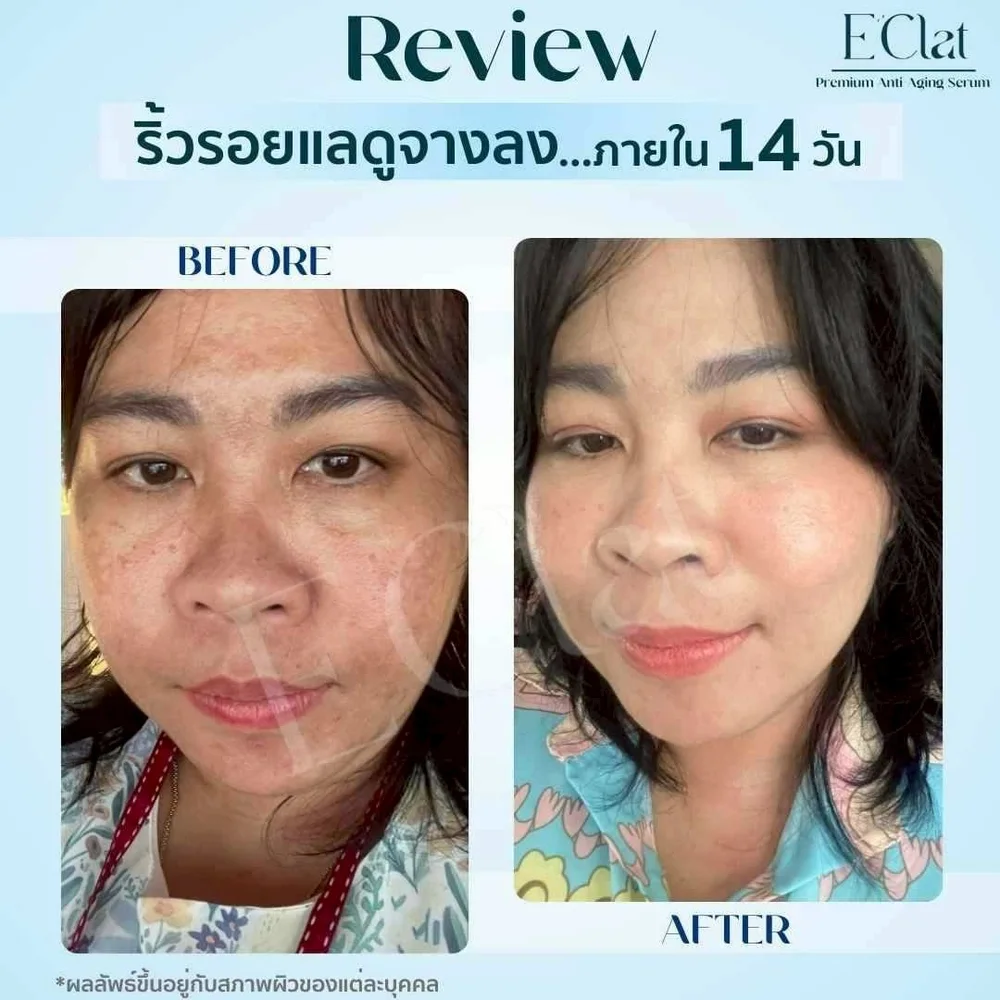 14 days customer review