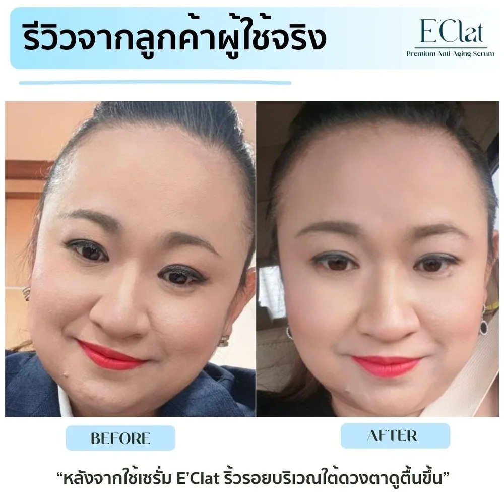 Before after customer review